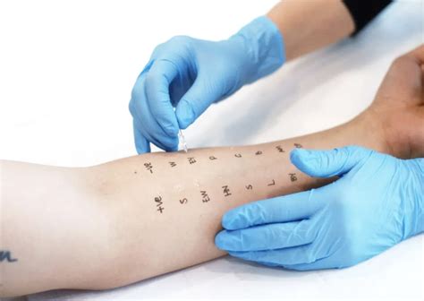 scratch test definition science|picture of allergy skin test.